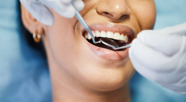 Best Mobile Emergency Dentist in Aviston, IL